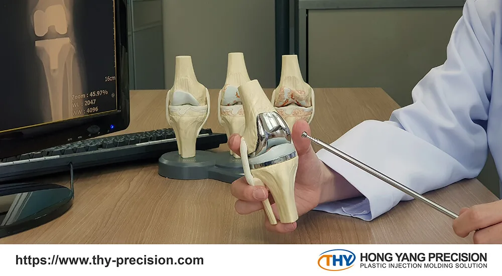 What are Medical Device Implants